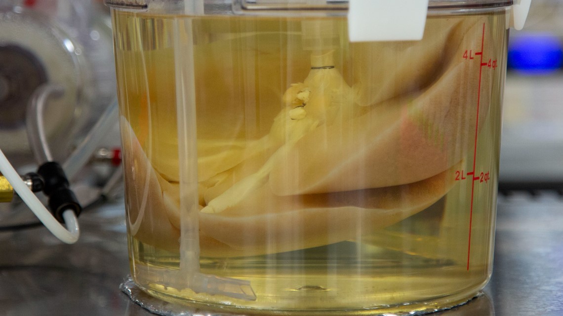 Pig livers could be the next transplant breakthrough - Vimarsana News