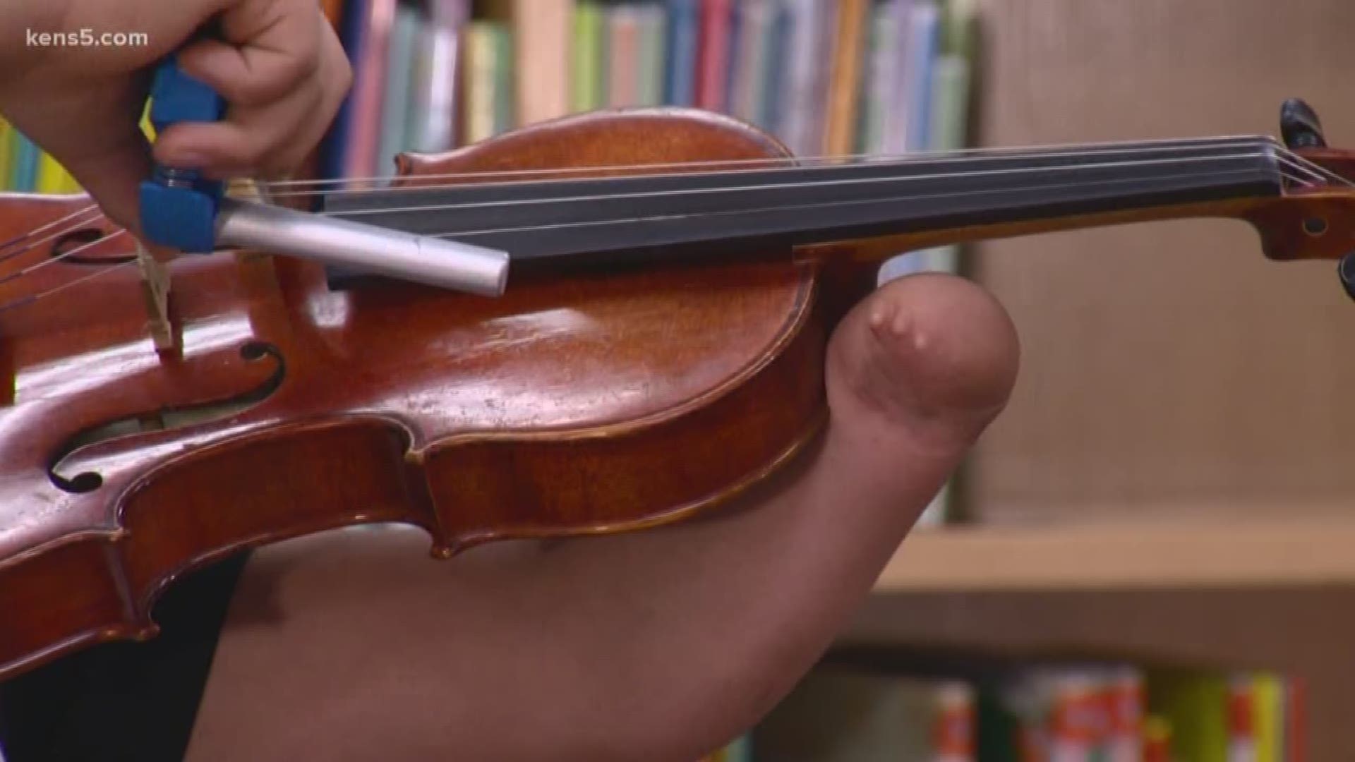 A team at Northside ISD collaborated to create a 3-D-printed prosthetic that a 5th grader could use to create music and achieve his dreams.