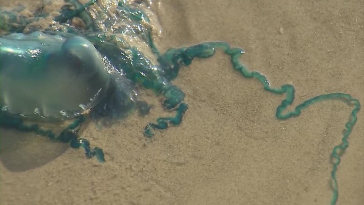 VERIFY: No, peeing on a jellyfish sting does not relieve the pain