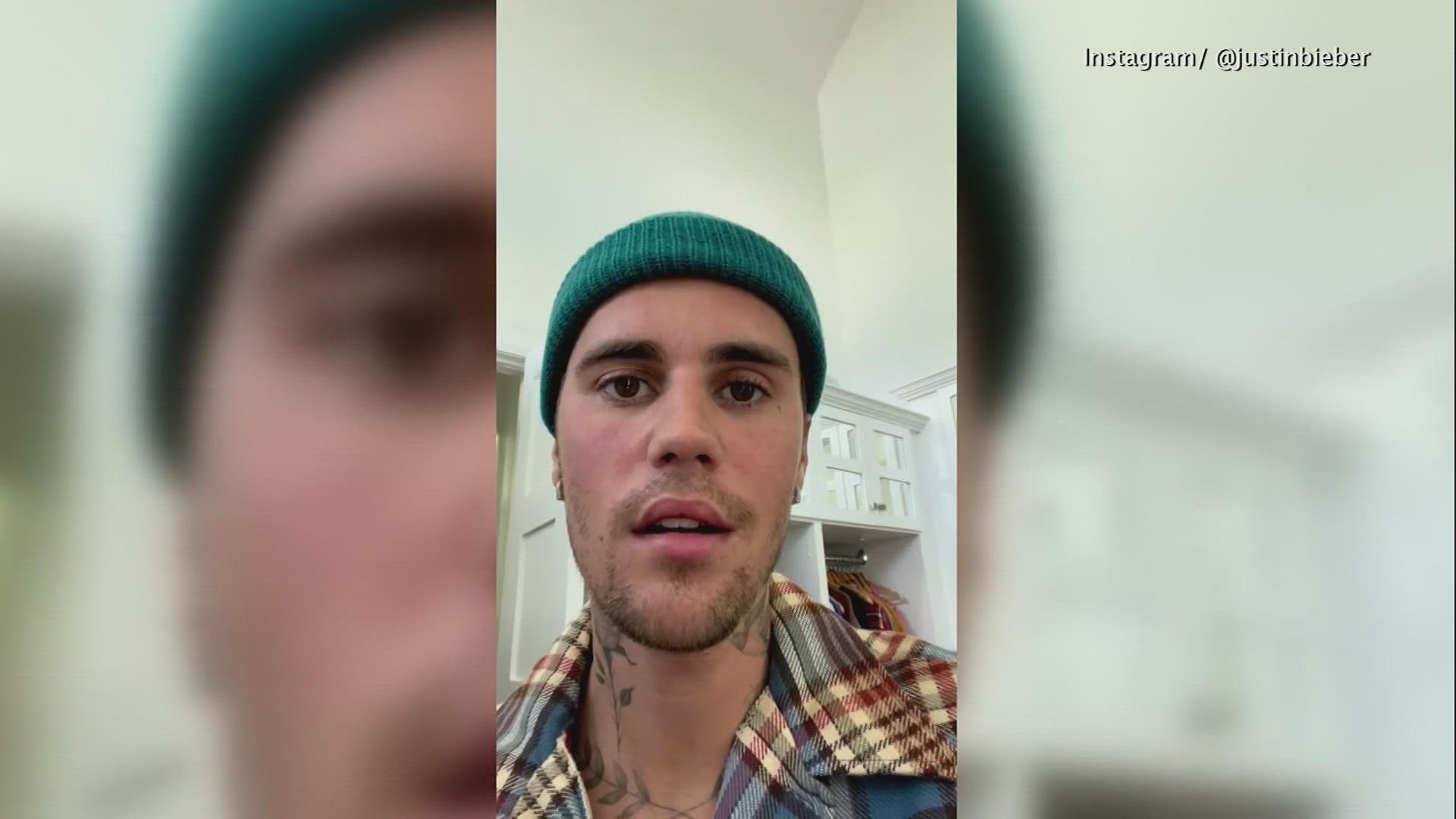 Pop superstar Justin Bieber announced the diagnosis last week, showing how one side of his face is paralyzed now.