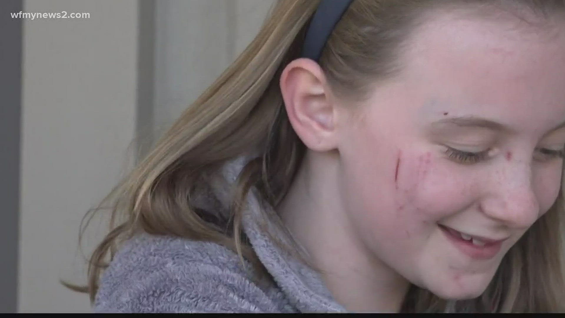 A 9-year-old is recovering from her injuries after being attacked by a coyote. Madilyn Fowler says she was standing outside her home Thursday evening, when a coyote rounded the corner and charged at her, showing its teeth, then biting at her dress as she raced for the door of her house.