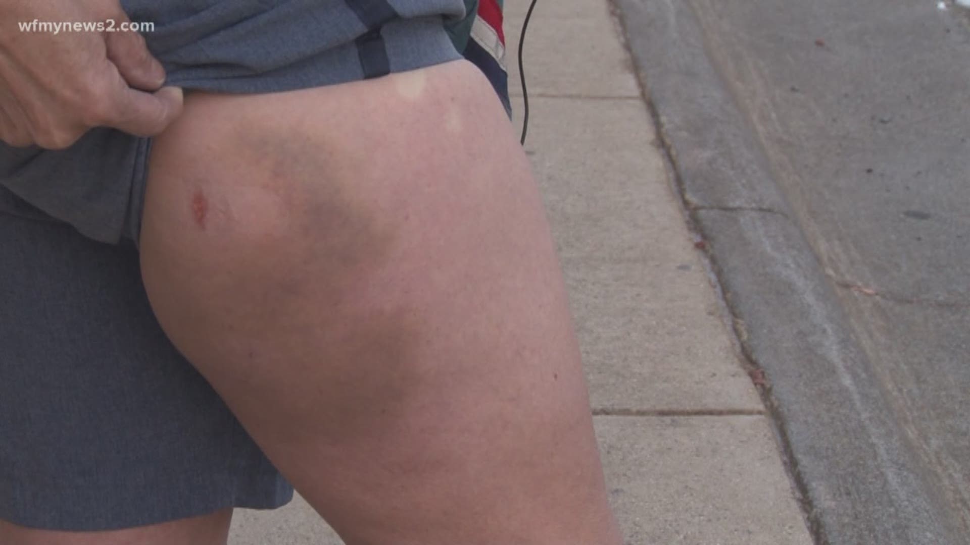 Postal Service Worker Attacked By Dog
