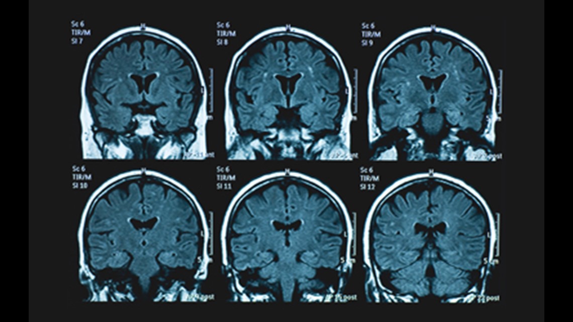 Coping with the emotions of diagnosing Alzheimer’s disease