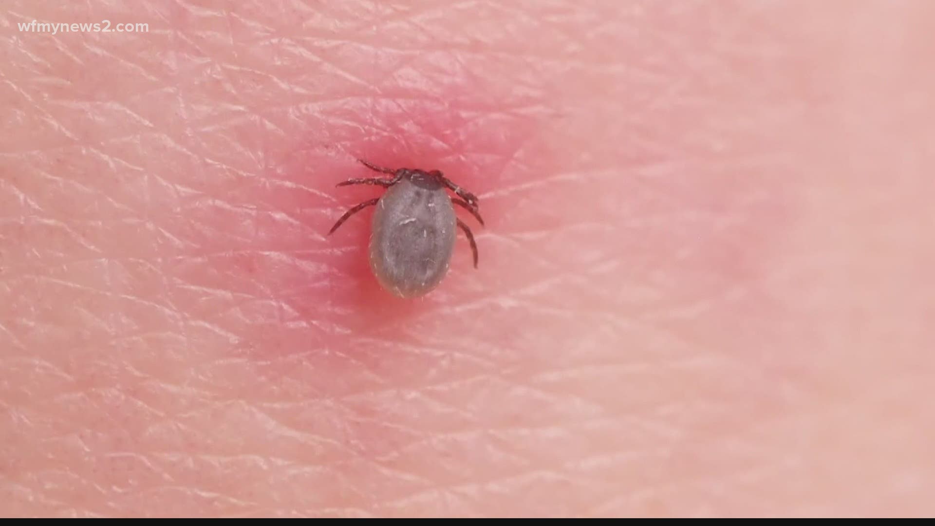 Ways to keep the ticks away: Wear long sleeves and pants, tuck your pants into your socks and wear insect repellent.