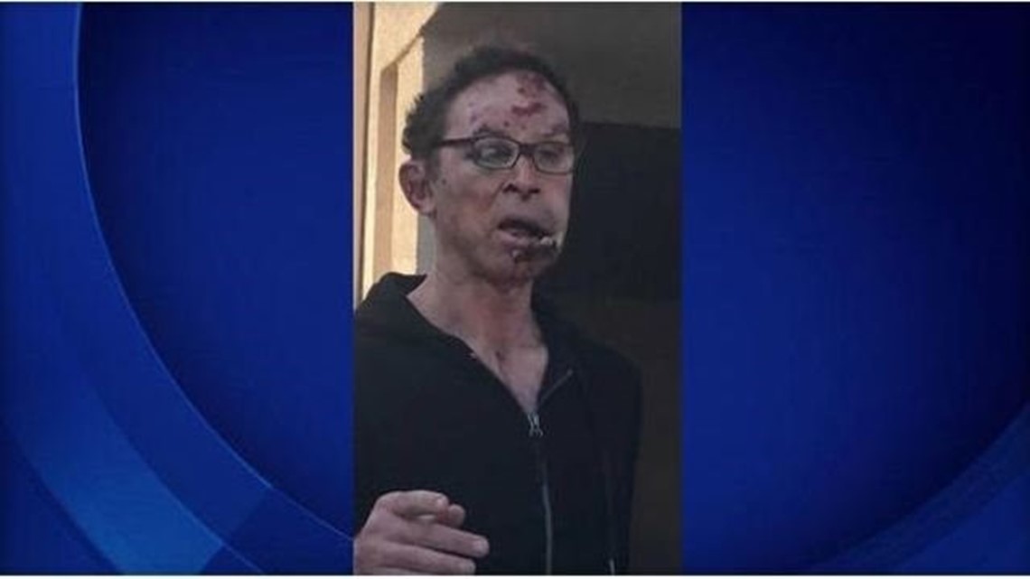 Former Pro Wrestler Tom Magee Severely Beaten Over Parking Spot ...