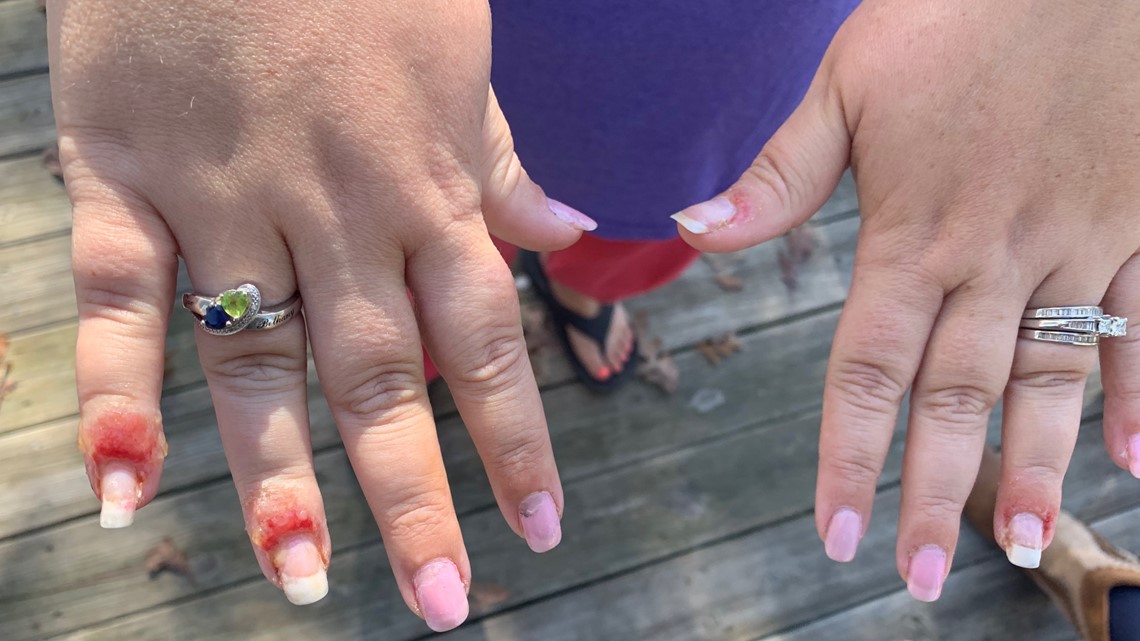 Woman Claims Trip To Nail Salon Left Her With A Fungal Infection Wfmynews2 Com