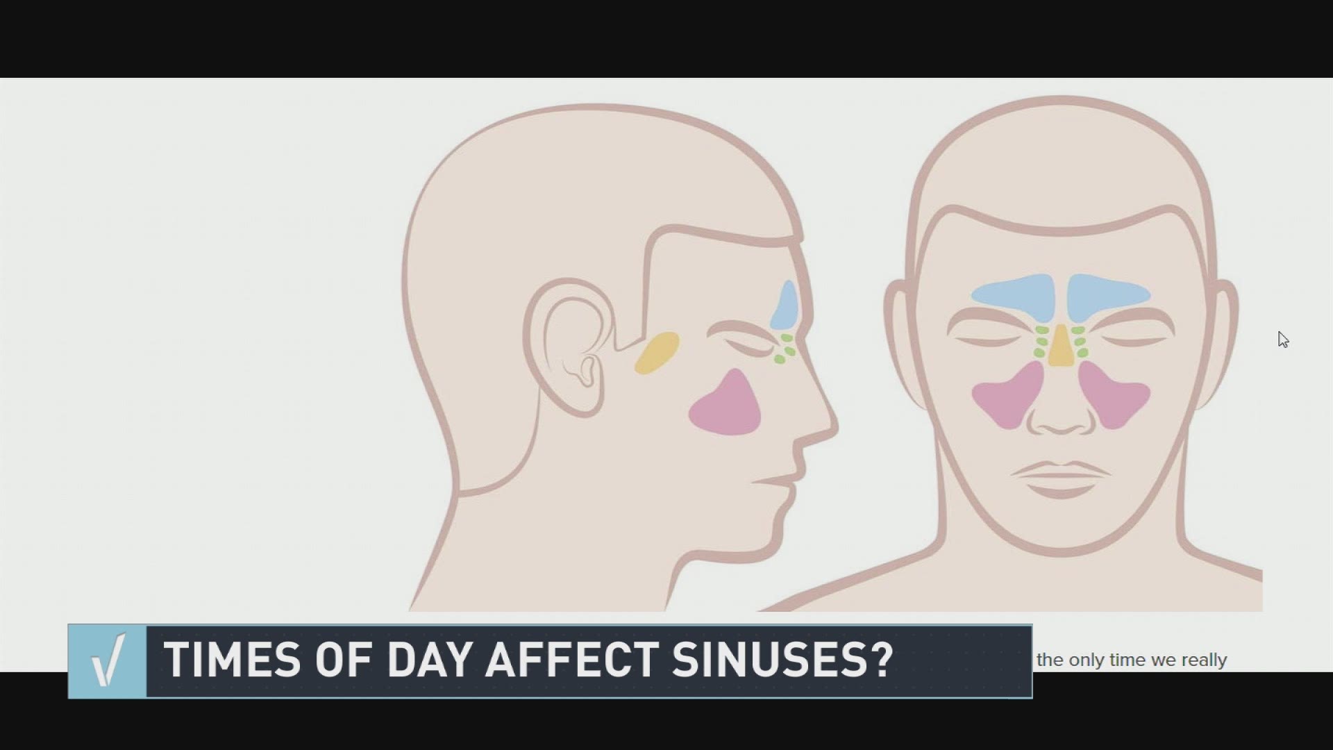 Verify: Sinuses?