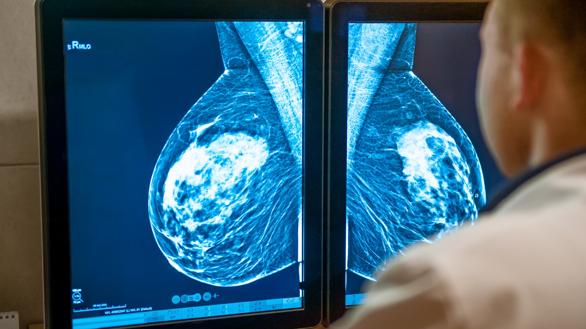 Getting screened for breast cancer can be key to stopping it. Knowing when to go and what to expect can help make it easier.