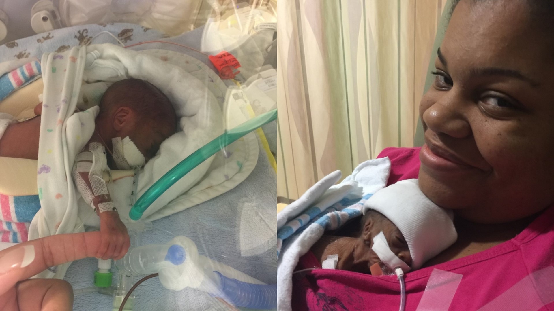 Nano-Preemie Velvett Fern's Birth Journey 