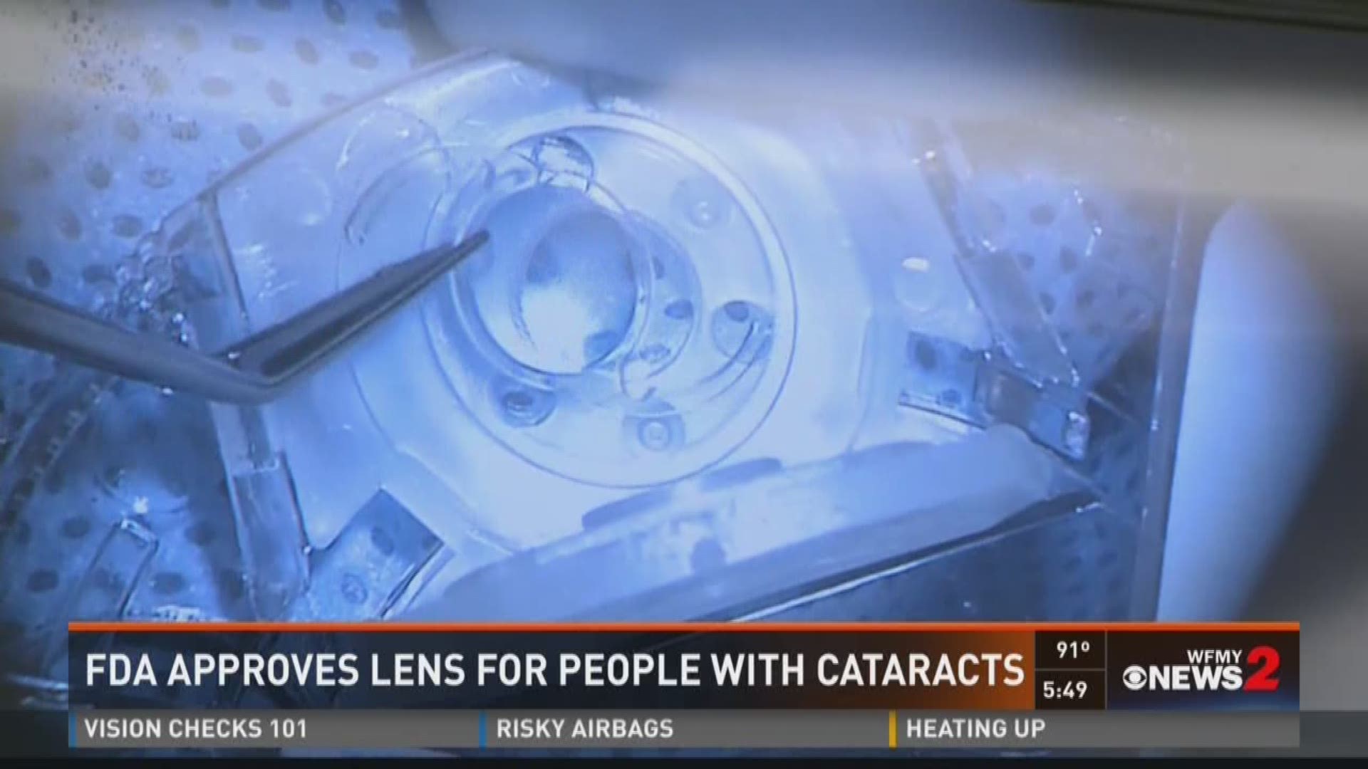 FDA Approves New Lens For Cataract Patients
