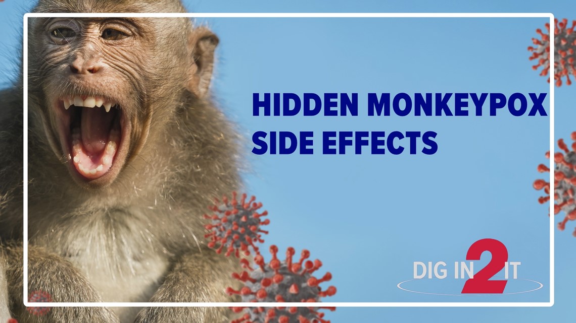 What is monkeypox and what does it look like?