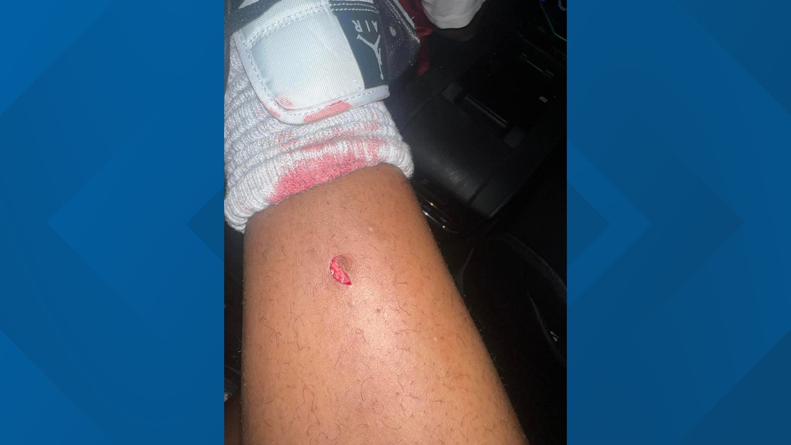 Teen grazed by bullet after Dudley football game - Vimarsana News
