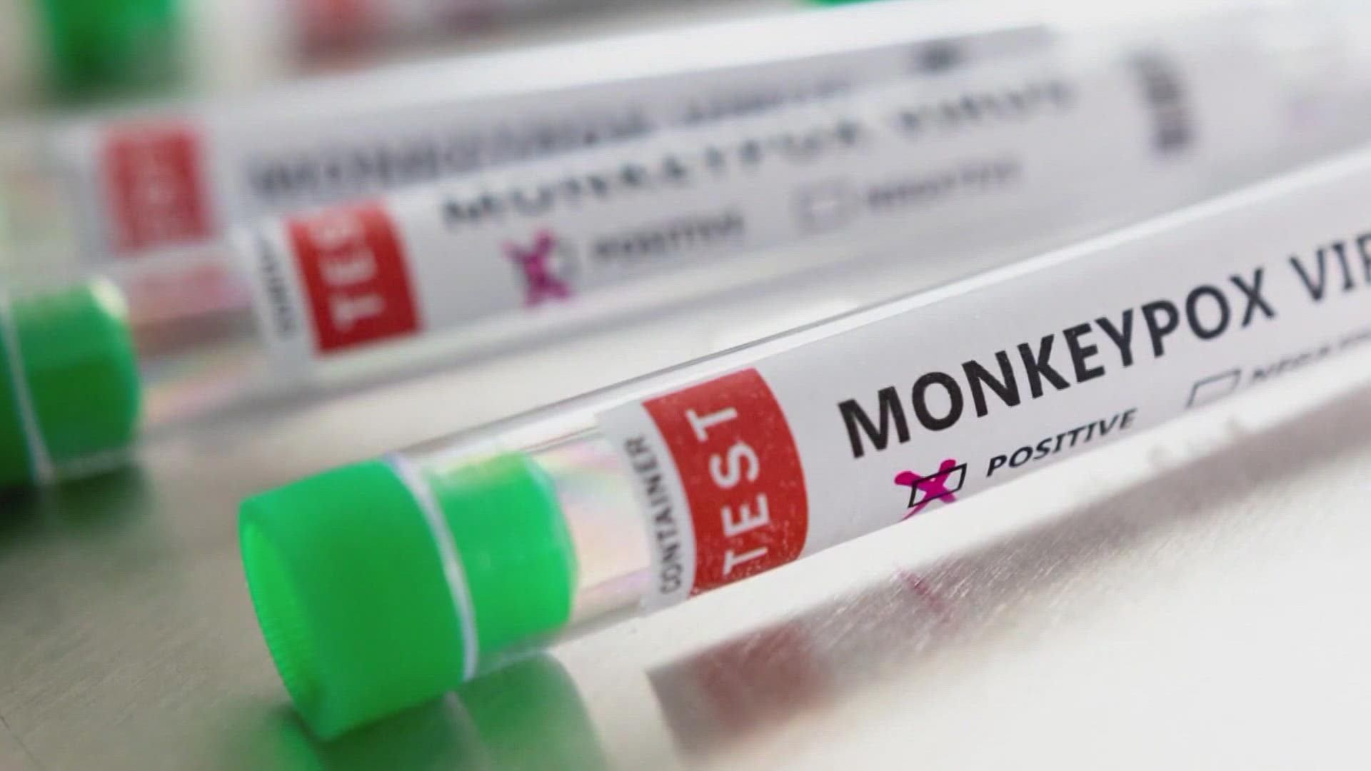 Triad health officials urge people not to panic over the spread of monkeypox.