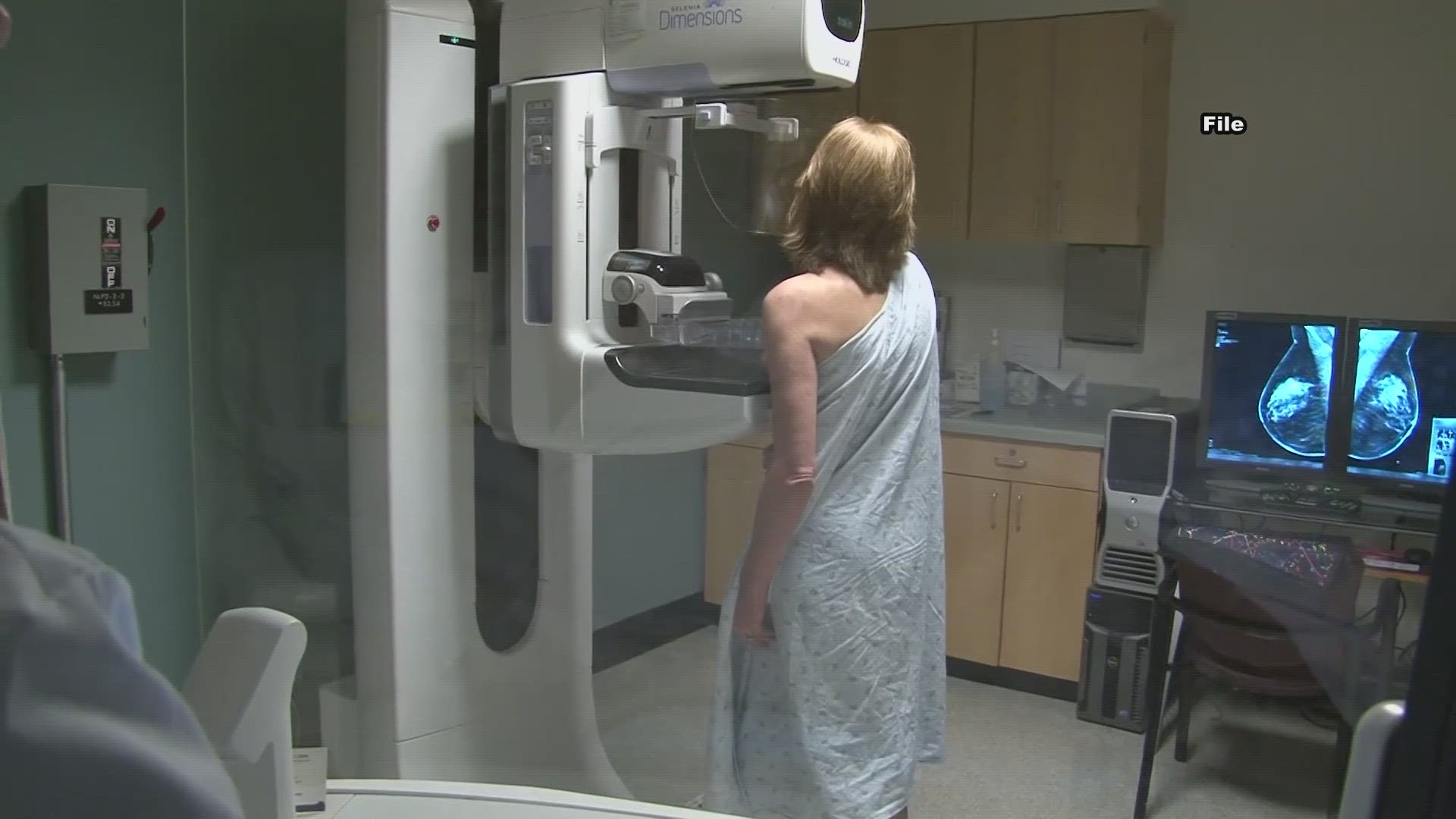 An oncologist said she was already encouraging patients to get screened for breast cancer when they turned 40.