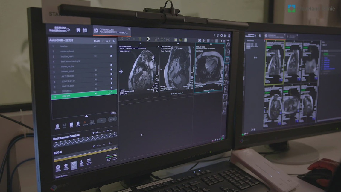 AI technology revolutionizes heart scan interpretation with 99% accuracy