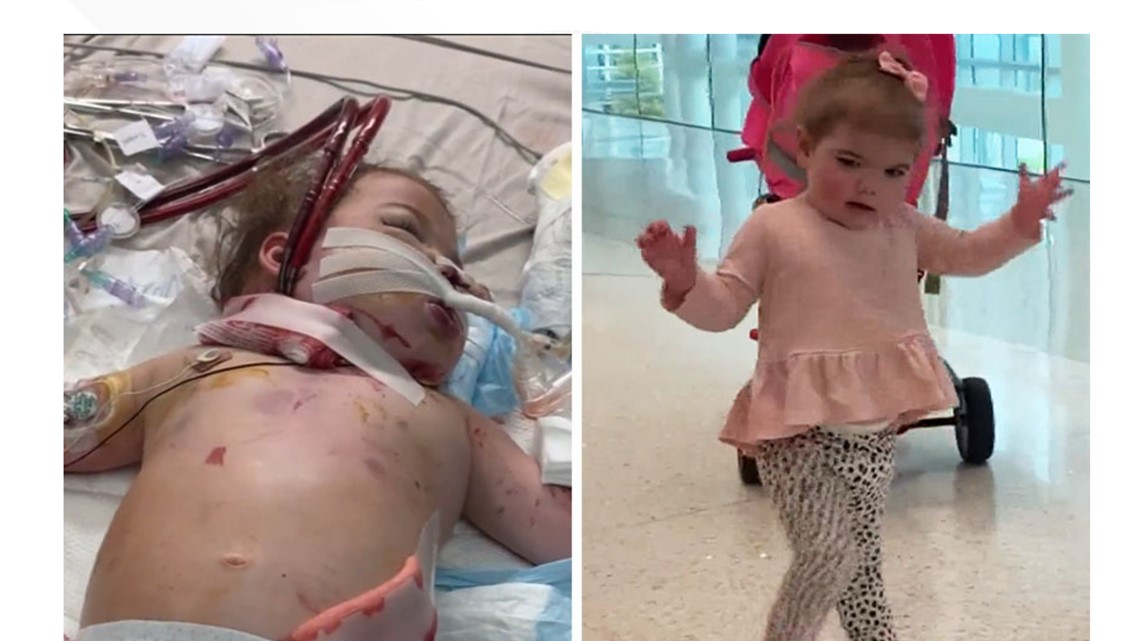 Miraculous: They were talking 'end of life' - 73 days later Mandeville baby ready to leave hospital - Vimarsana News